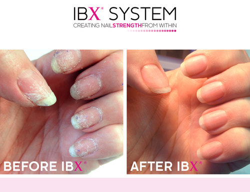 2014-09-ibx_beforeafter-look-book-6